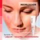 RedBlocker Serum punktowe do skóry wrażliwej i naczynkowej dzień noc 30 ml